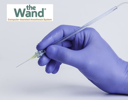 Sedation Dentistry - The Wand